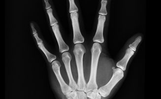125 Jahre Röntgenstrahlung in der Medizin